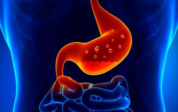 Gastritis crónica Tipo de gastritis crónica