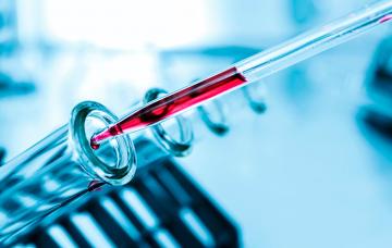 Diagnóstico de la tularemia Diagnóstico de la tularemia: análisis de sangre