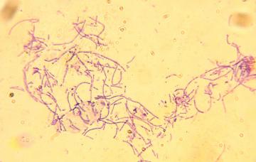 Bacillus anthracis