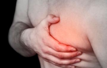 Varón con cáncer de mama