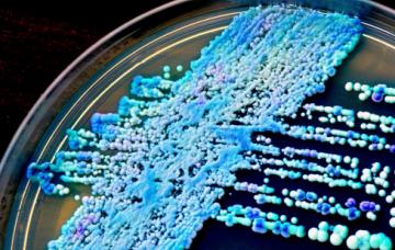 Causas de candidiasis Causas de candidiasis