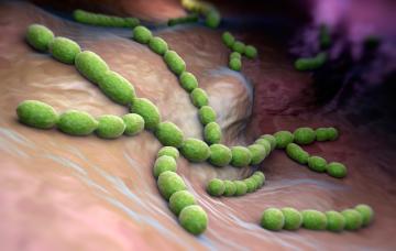 Causas de la meningitis Causas víricas de la meningitis