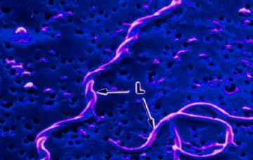 bacteria llamada Haemophilus ducreyi