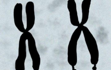 Diagnóstico genético del síndrome de X frágil