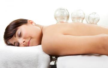 Mujer con ventosas de cupping en la espalda