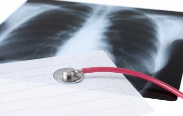 Diagnóstico de bronquitis