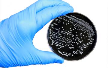 Diagnóstico de la infección por Campylobacter