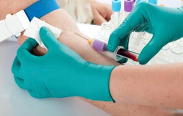 Análisis de sangre para un cólico nefrítico