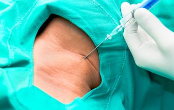 Diagnóstico del herpes