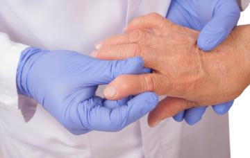 Diagnóstico del lupus Diagnóstico del lupus por parte del médico