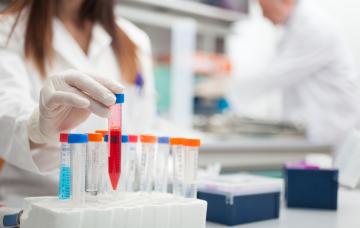 Realización del diagnóstico de la mononucleosis infecciosa