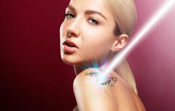 Cómo eliminar un tatuaje