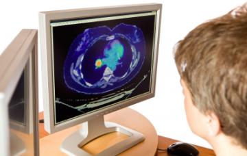 Pruebas de imagen para detectar el cáncer de pulmón Diagnóstico del cáncer de pulmón