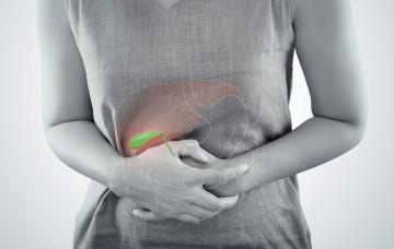 Litiasis biliar Persona con dolor abdominal