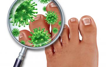 Hongos presentes en el pie de atleta