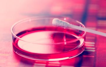 Test de dimetilglioxima Prevención de la alergia al níquel