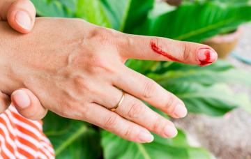 Hemorragia en un dedo, síntoma de la hemofilia