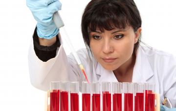 Tipos de anemias Clasificación de las anemias