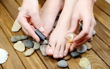 Tratamiento y prevención de la onicomicosis