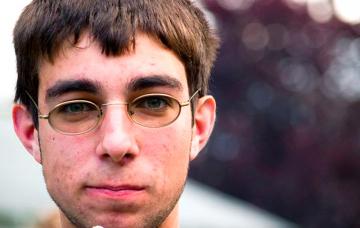 Chico con acné severo