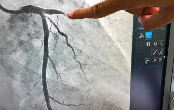 Angiografía Angiografía