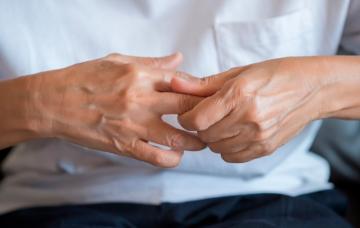 Paciente con artritis reumatoide