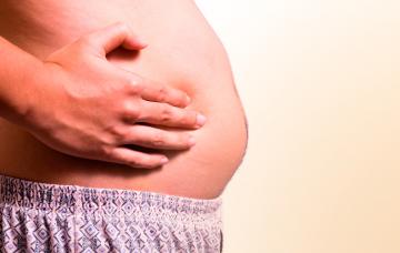 ¿Qué es la ascitis? Hombre con ascitis