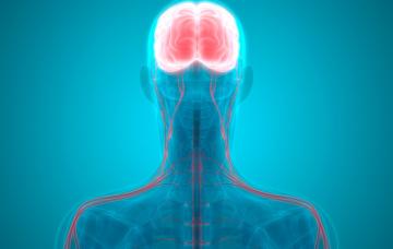 Ataxia Ataxia cerebral