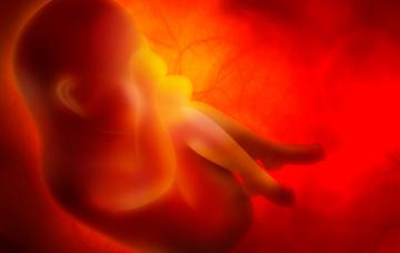 Biopsia corial Biopsia corial