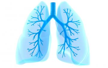 Cáncer de pulmón Qué es el cáncer de pulmón