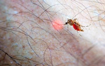 Qué es la fiebre de chikungunya Chikungunya