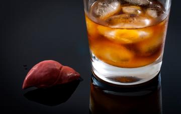 Hígado, cirrosis y alcohol