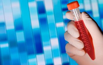 Conservación de las células madre del cordón umbilical Conservación de las células madre del cordón umbilical