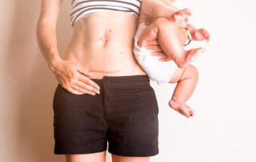 Mujer muestra su cicatriz por cesárea en su abdomen