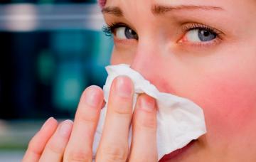 Síntomas del catarro Catarro