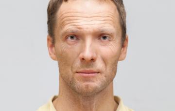 Día mundial de las Lipodistrofias