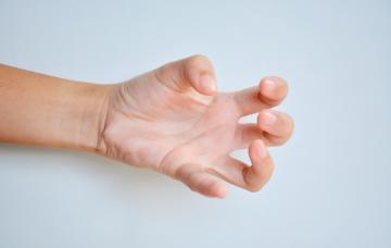 Qué es la distonia Distonías, contracciones involuntarias