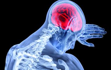 Qué es la encefalitis