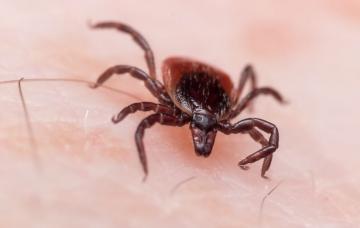 Enfermedad de Lyme, borreliosis por garrapatas Garrapata transmisora de Enfermedad de Lyme o borreliosis por garrapatas