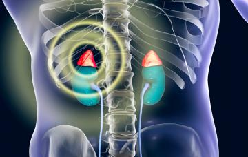 Ilustración de la enfermedad de Addison