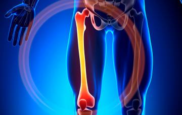 Enfermedad de Paget Ilustración explicativa de la enfermedad de paget