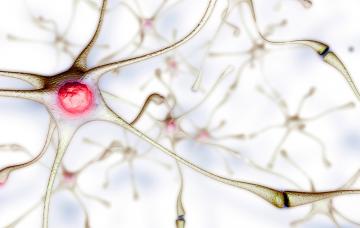 Esclerosis múltiple