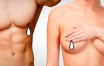 Galactorrea Galactorrea