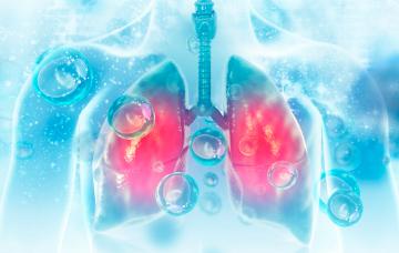 Melioidosis Melioidosis, una enfermedad tropical infecciosa