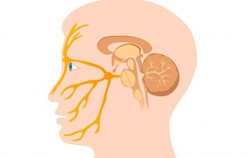 Neuralgia del trigémino facial Neuralgia del trigémino