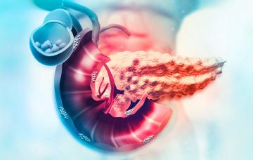 Pancreatitis Hombre afectado por pancreatitis