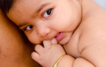 Niño con poliomelitis