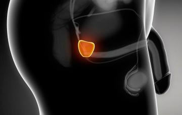 Qué es el PSA Qué es el PSA