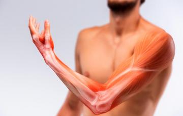 Sarcoma de tejidos blandos