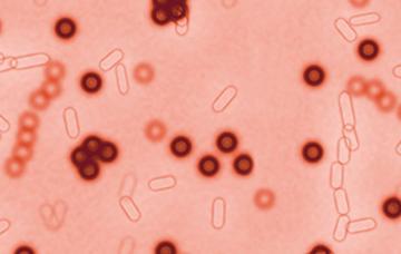Shigella o shigelosis Infección por Shigella o shigelosis